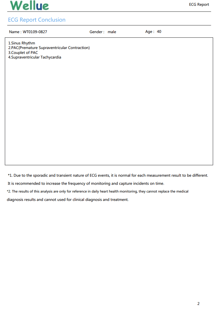 Informe detallado de ECG, ritmo sinusal, CAP, contracción supraventricular prematura, pareado de CAP, taquicardia supraventricular