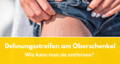 dehnungsstreifen oberschenkel