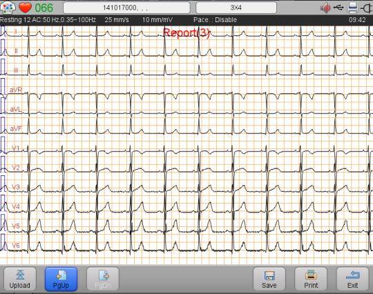 Echtzeit-EKG-Kurven
