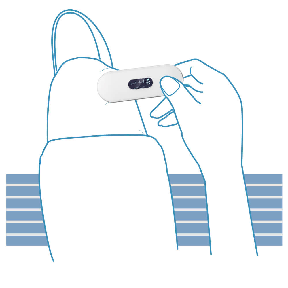 Electrocardiograma de derivación II
