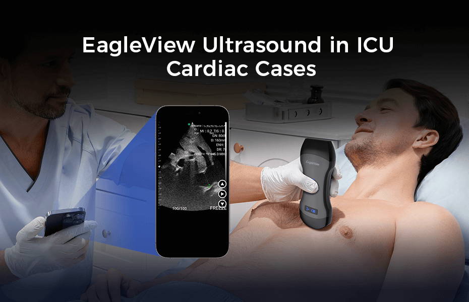 EagleView Portable Ultrasound in ICU Cardiac Cases