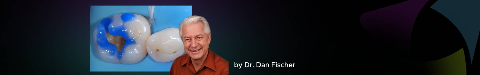 a blog post banner with Dr. Dan Fischer and the etched tooth