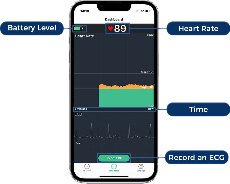 mdcubes 24-hour heart monitor with real-time ecg heart rhythm tracking app