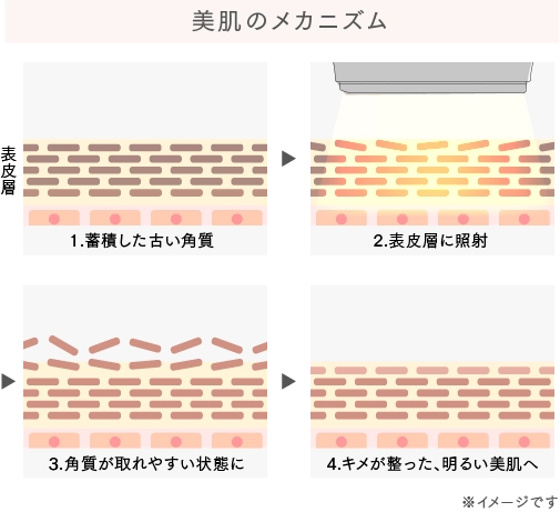 メカニズム