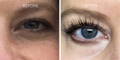 Nulastin Lash Serum Results Before After