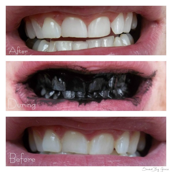 How to Use Activated Charcoal - Gold Mountain Beauty