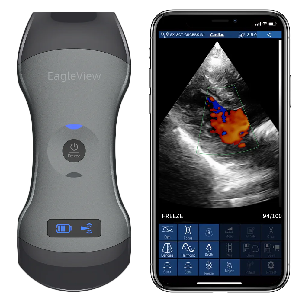 Échographie portative sans fil à double tête EagleView