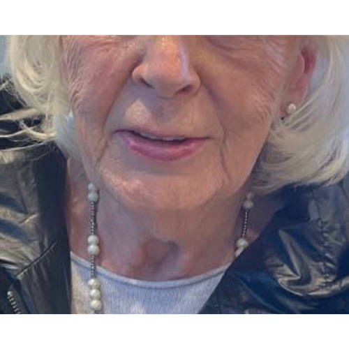 PERSONALISED MEDICAL SKINCARE Before
