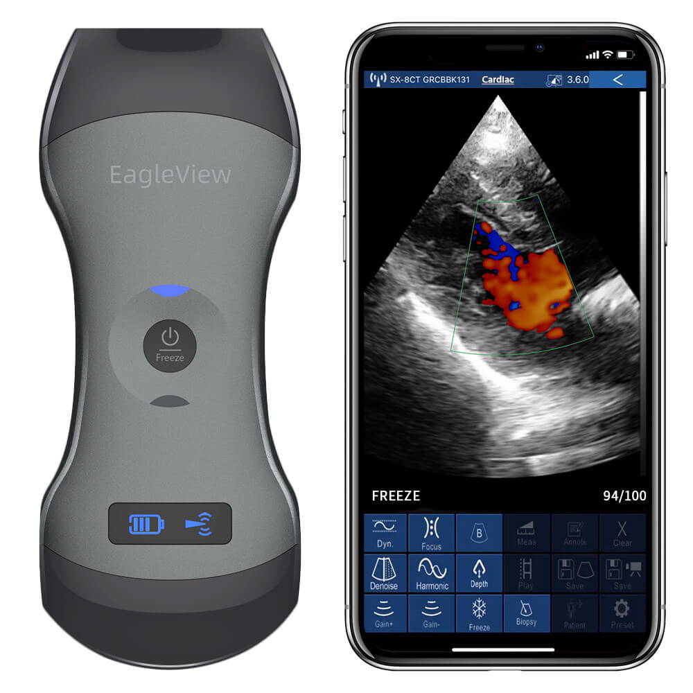 babytone smart fetal heart monitor