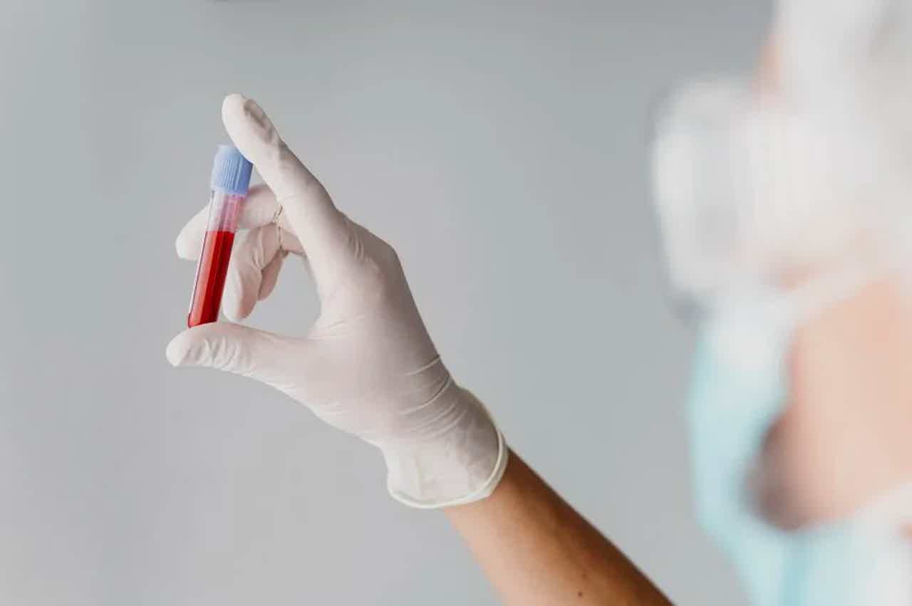 Gloved hand holding a red blood sample tube, other hand reaching blurred in background.