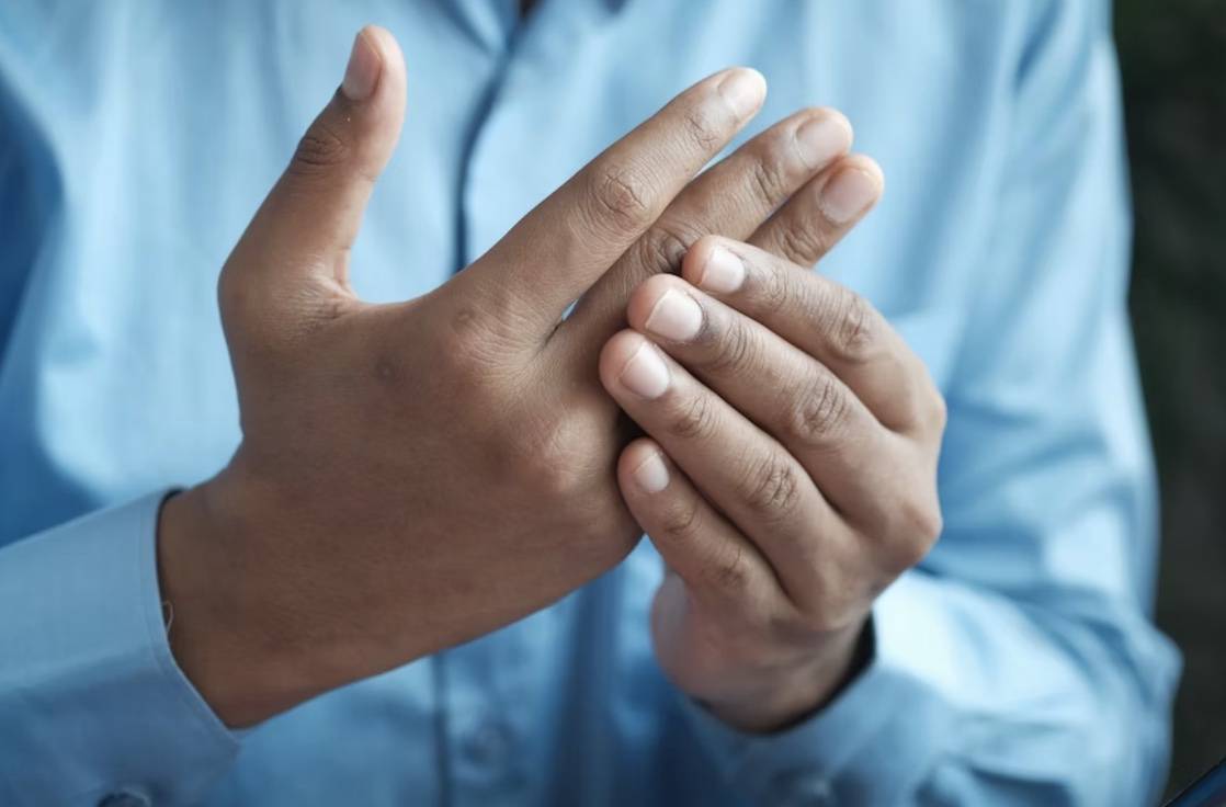 What Are the Symptoms of Arthritis?