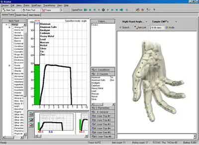 Electrodermal Screening: Tuning into Your Body’s Energy for Better Health