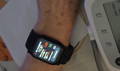Customer photo of the Wellue blood pressure watch showing blood pressure data on the screen