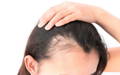 Lavender oil is a natural, herbal way to prevent shedding hair and hair breakage.