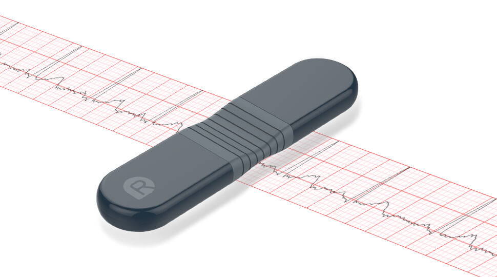 limited-time deal of wellue 24-hour ecg/ekg recorder with ai analysis