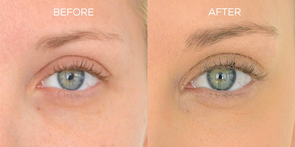Before and After Results Using BROW Shape Altering Serum with Keracyte® Elastin Complex