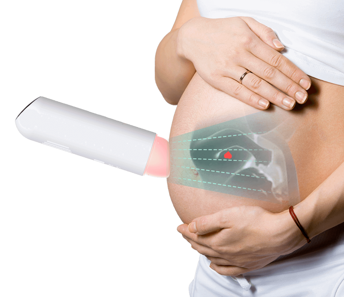 Babydoppler. Fetaler Doppler mit APP. Baby-Herzschlag-Doppler. Baby-Herzschlagmonitor. BabyTone™ Smarter fetaler Herzmonitor. Einteiliger fetaler Herzmonitor mit APP. Tragbarer fetaler Doppler. Ultraschall Fetal Doppler. APP für langfristiges Tracking. Taschen-FHR-Detektor. Verfolgen Sie die fetale Herzfrequenz zu Hause.