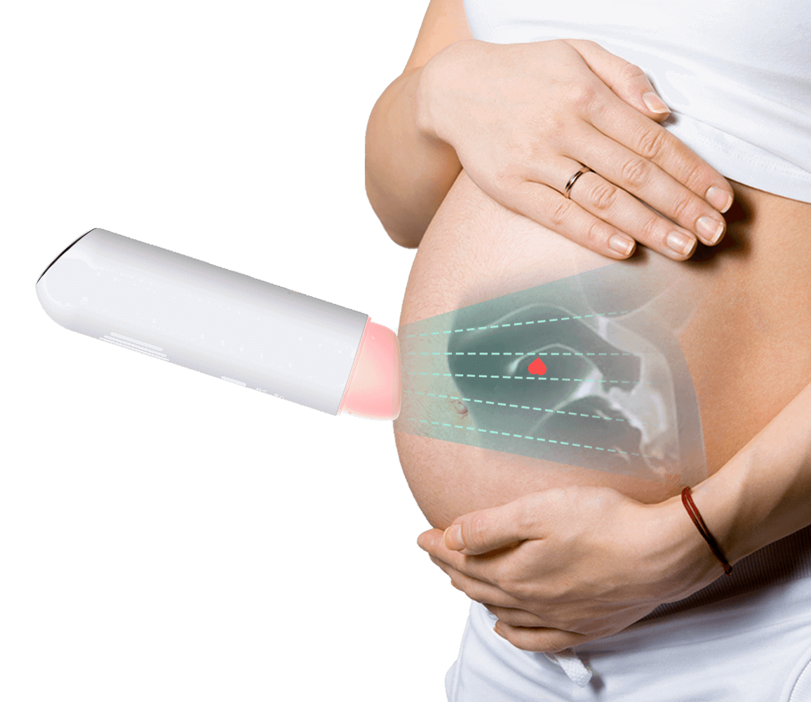 Doppler shop device pregnancy
