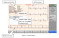 Rapporto di analisi macchina ECG Wellue Biocare iE300 1 interfaccia con informazioni come risultato dell'analisi, forme d'onda e frequenza cardiaca.