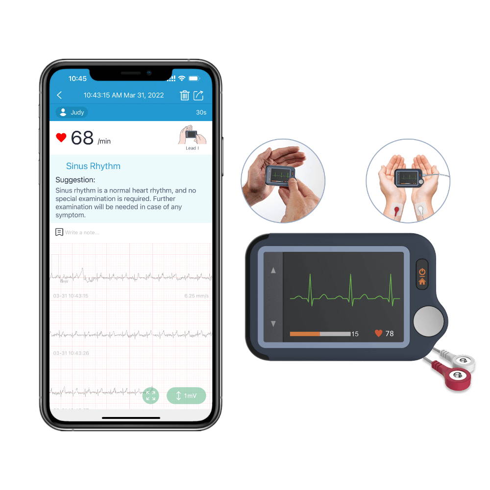 Portable ECG/EKG Monitor with OLED Screen- Detect Arrhythmias with Your  Fingers – Wellue