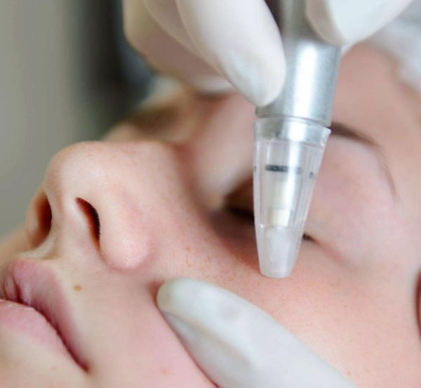 Lovely Skin and Beauty - Skin Tightening – Full Face - Image 4