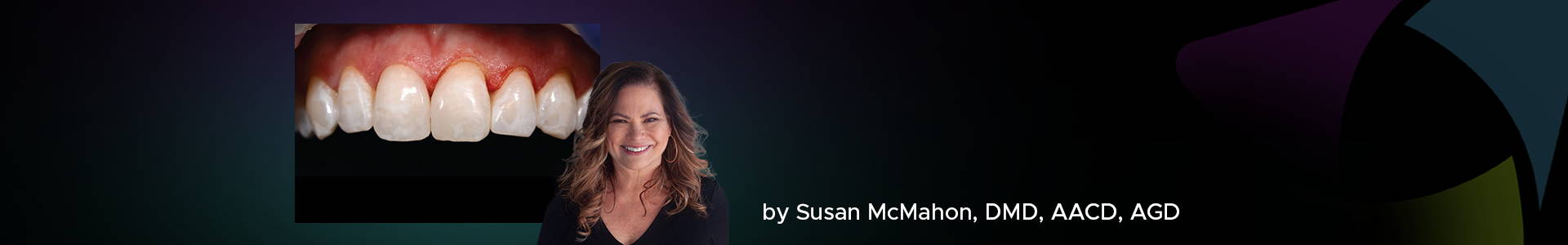 blog banner featuring Dr Susan McMahon and a clinical image behind