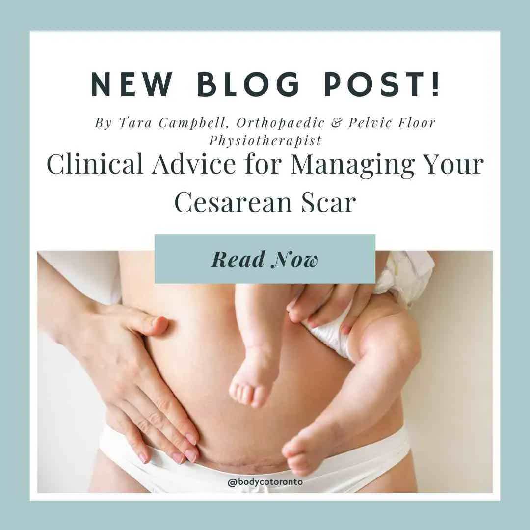 Clinical Advice for Managing Your Cesarean Scar