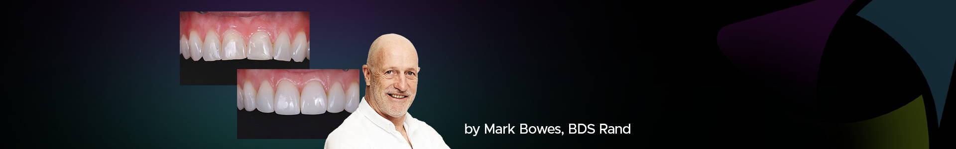 banner featuring Dr Mark Bowes and two clinical images