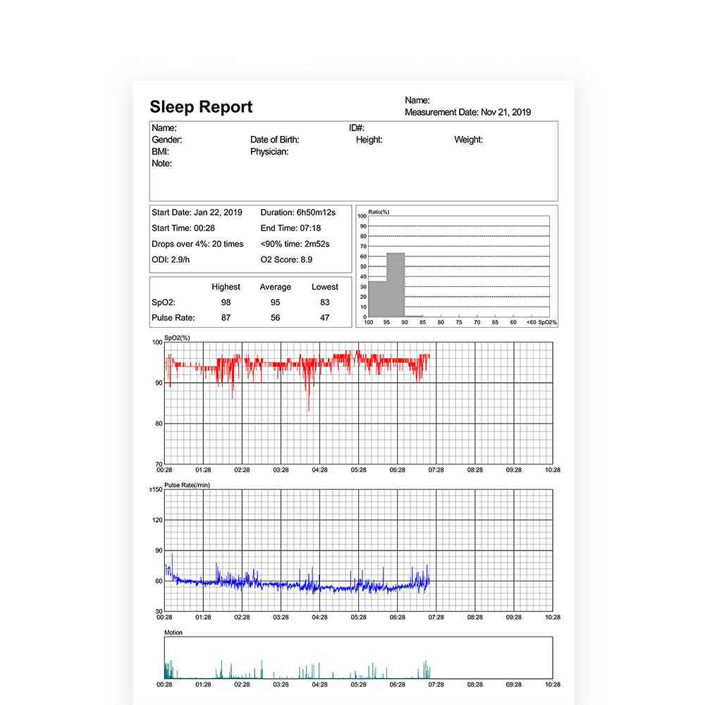 sleep report