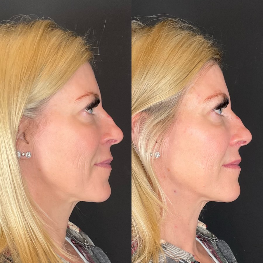 Transformation image 4