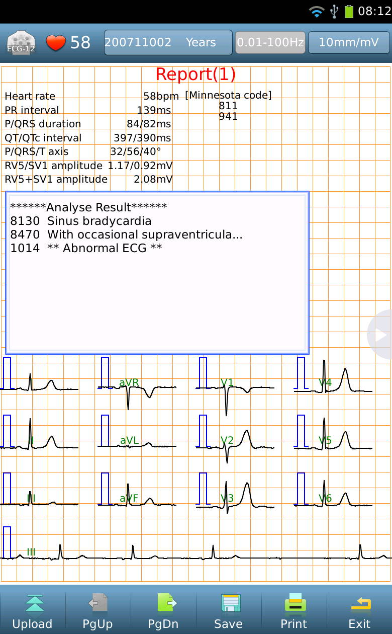 12-Lead ECG Tablet