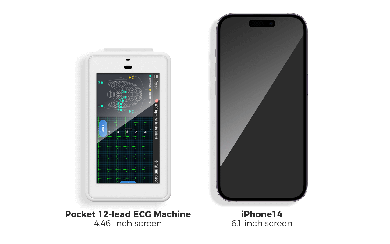 pocket 12-lead ECG machine with a size smaller than iPhone 14