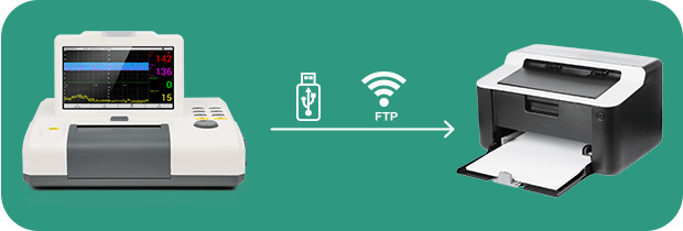 imprimir informes del monitor fetal con una unidad USB o una impresora de red