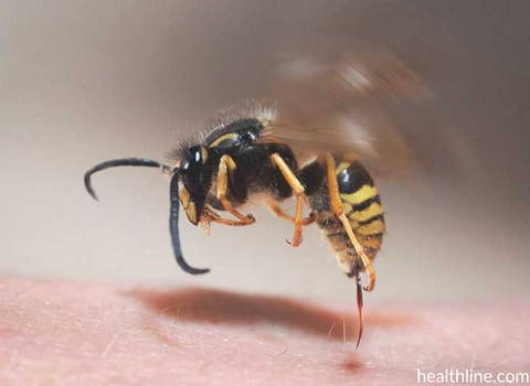 wasp-insect-sting