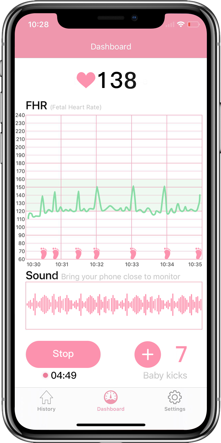 APP pour moniteur cardiaque fœtal intelligent Babytone