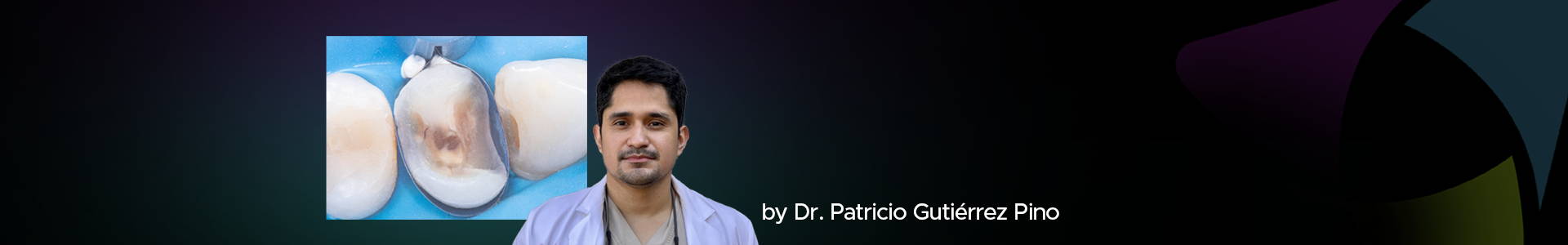 blog banner featuring Dr Pino and a clinical image