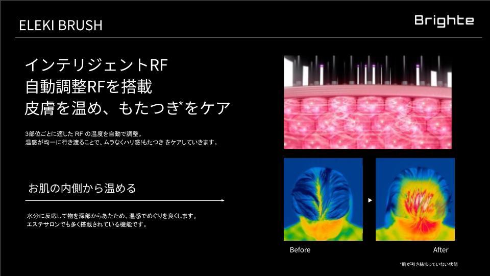 RF