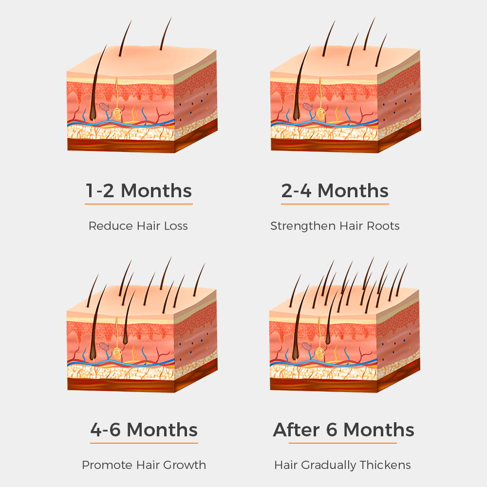 what to expect from laser therapy