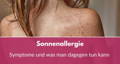sonnenallergie