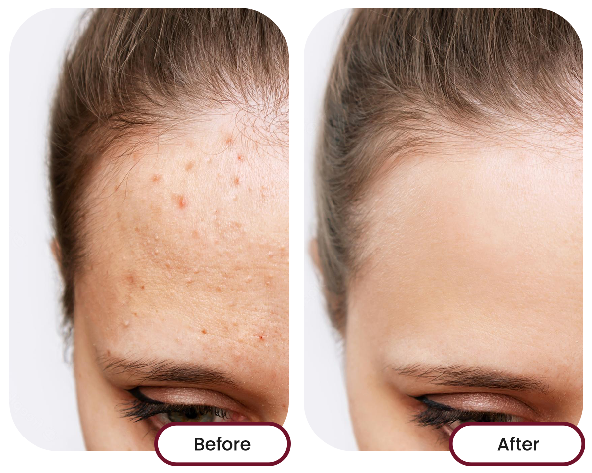 Before and after images of taking nano singapore's collagen drink