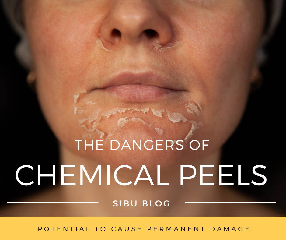 dangers of chemical peels
