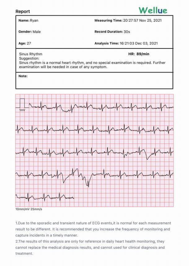 مراقبة ضغط الدم الرقمية مع ECG / EKG