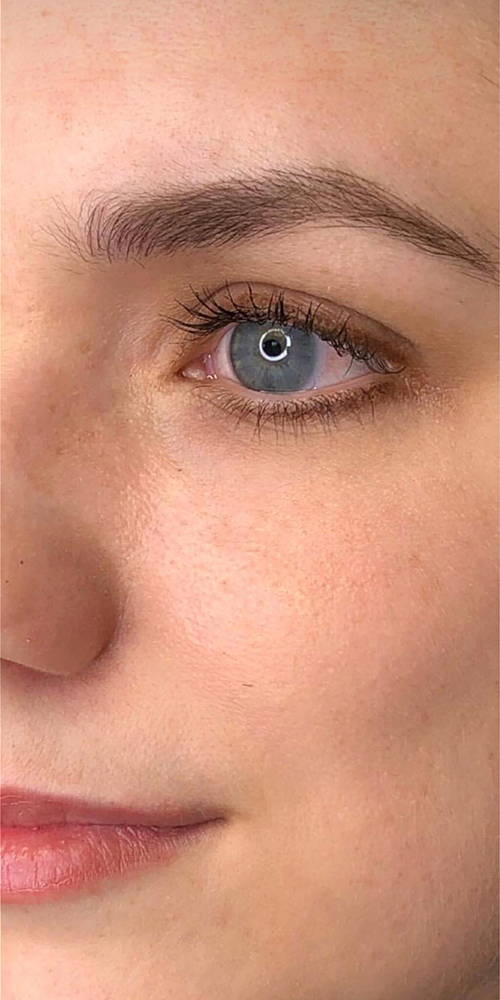 WunderHaut Anti-Aging Genius™ mit Radiofrequenz, LED Licht- und Mesotherapie, EMS und Elektroporation