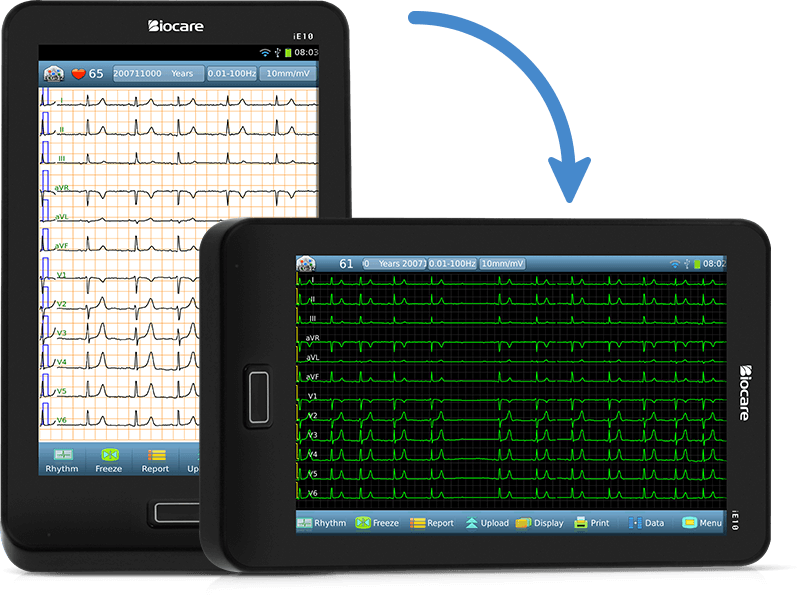 يمكن اختيار الشاشة الأفقية أو الرأسية لجهاز تخطيط القلب ذو 12 سلكًا.