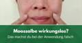 Wie man die Moossalbe richtig anwendet für optimale Wirkung