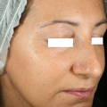 before and after model image shots