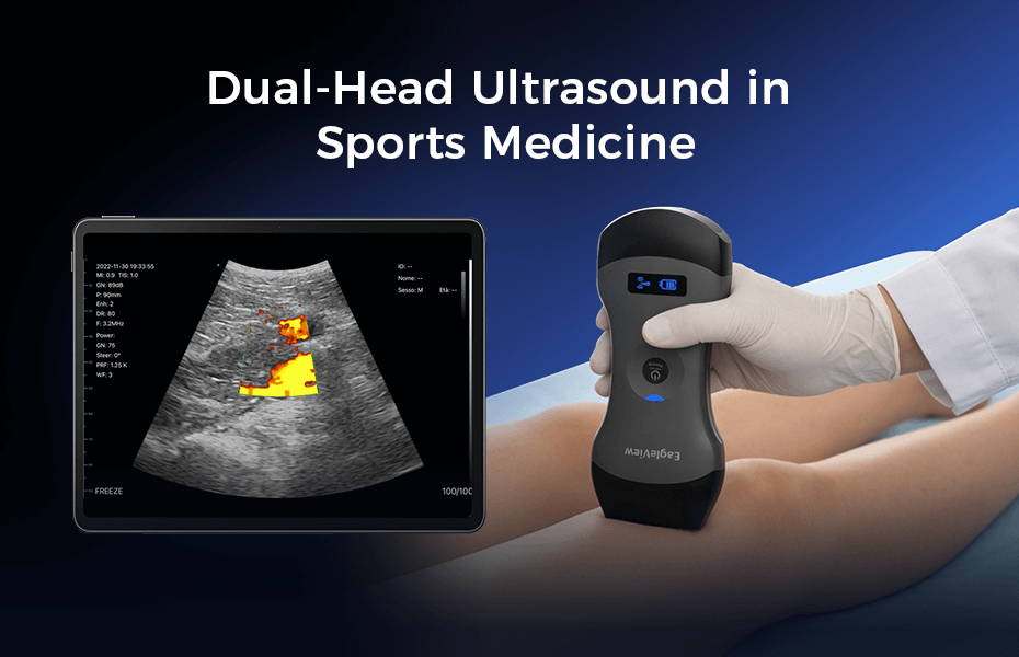 The Practice of EagleView Wireless Ultrasound in Sports Medicine