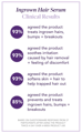 EWC Ingrown Hair Serum Clinical Results Graphic