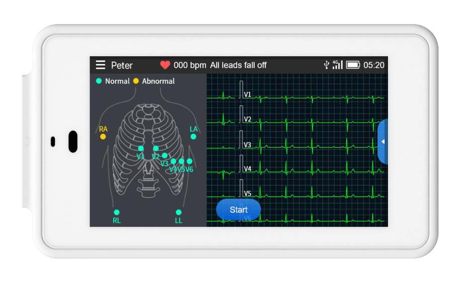 Guide de placement ECG à l'écran