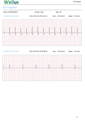EKG/EKG-Streifen